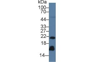 Western Blot; Sample: Human Serum; Primary Ab: 3µg/ml Mouse Anti-Human REG3g Antibody Second Ab: 0.
