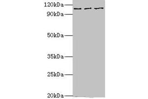 Western blot All lanes: MERTK antibody at 10 μg/mL Lane 1: Mouse gonad tissue Lane 2: Mouse lung tissue Lane 3: Mouse kidney tissue Secondary Goat polyclonal to rabbit IgG at 1/10000 dilution Predicted band size: 110 kDa Observed band size: 110 kDa (MERTK anticorps  (AA 840-999))