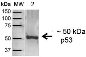 Western blot analysis of Human A431 showing detection of ~43. (p53 anticorps  (C-Term) (FITC))