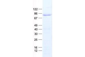 Validation with Western Blot