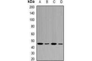 Western blot analysis of Fumarylacetoacetase expression in HepG2 (A), MCF7 (B), mouse liver (C), rat kidney (D) whole cell lysates. (FAH anticorps)