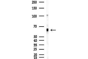 Western blot analysis of lysates from F10-LUC cells(starvation,24h treatment), using PIAS2 Antibody at 1/1000 dilution.