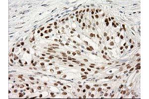 Image no. 5 for anti-Protein Kinase C, epsilon (PRKCE) antibody (ABIN1500229)