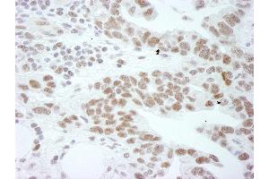 anti-DEAD (Asp-Glu-Ala-Asp) Box Polypeptide 1 (DDX1) (AA 500-550) antibody