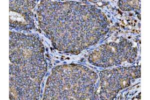 IHC analysis of ARL13B using anti-ARL13B antibody (ABIN7600179).