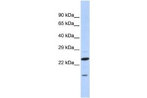 Western Blotting (WB) image for anti-Insulin Induced Gene 2 (INSIG2) antibody (ABIN2458474) (INSIG2 anticorps)