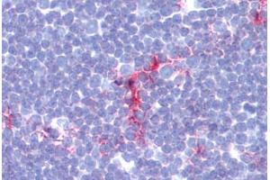 Human Thymus (formalin-fixed, paraffin-embedded) stained with CD1A antibody ABIN462117 at 1:100-1:200 followed by biotinylated goat anti-rabbit IgG secondary antibody ABIN481713, alkaline phosphatase-streptavidin and chromogen. (CD1a anticorps)