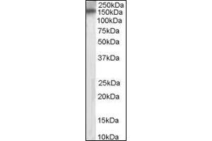 Image no. 1 for anti-Receptor Protein Tyrosine Phosphatase (PTPRT) (Internal Region) antibody (ABIN372866) (PTPRT anticorps  (Internal Region))