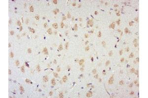 Paraformaldehyde-fixed, paraffin embedded rat brain, Antigen retrieval by boiling in sodium citrate buffer (pH6) for 15min, Block endogenous peroxidase by 3% hydrogen peroxide for 30 minutes, Blocking buffer (normal goat serum) at 37°C for 20min, Antibody incubation with p70 S6 Kinase Beta (Thr444 + Ser447) Antibody, Unconjugated  at 1:400 overnight at 4°C, followed by a conjugated secondary and DAB staining.