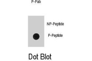 Dot blot analysis of EGFR (phospho Y1016) polyclonal antibody  on nitrocellulose membrane. (EGFR anticorps  (pTyr1016))
