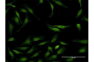 Immunofluorescence of monoclonal antibody to STAT6 on HeLa cell.