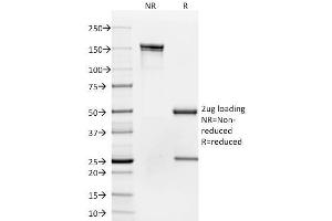 SDS-PAGE AnalysisPurified CD35 Mouse Monoclonal Antibody (To5).