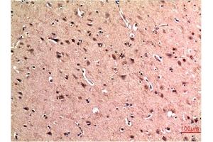 Immunohistochemical analysis of paraffin-embedded Human Brain Tissue using Beclin-1 Mouse mAb diluted at 1:200.