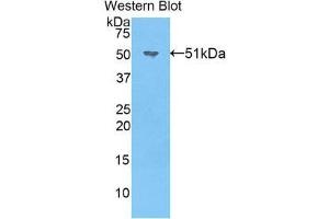 Western Blotting (WB) image for anti-Noggin (NOG) (AA 116-232) antibody (ABIN1860019) (NOG anticorps  (AA 116-232))