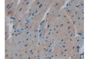 Detection of TFR2 in Mouse Heart Tissue using Polyclonal Antibody to Transferrin Receptor 2 (TFR2)