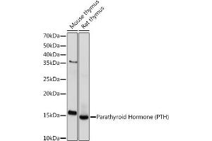 Western blot analysis of extracts of various cell lines, using Parathyroid Hormone (PTH) (PTH) Rabbit mAb (ABIN7269175) at 1:1000 dilution. (PTH anticorps)