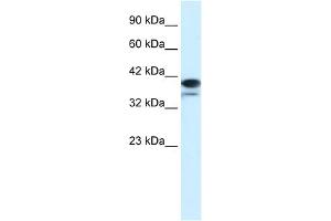 WB Suggested Anti-PAntibody Titration:  1. (PARP6 anticorps  (N-Term))