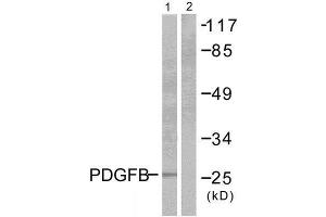 Western Blotting (WB) image for anti-Platelet Derived Growth Factor Subunit B (PDGFB) (Internal Region) antibody (ABIN1848736) (PDGFB anticorps  (Internal Region))