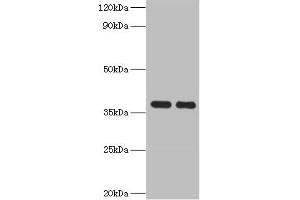 Western blot All lanes: GALM antibody at 2 μg/mL Lane 1: Mouse kidney tissue Lane 2: Rat adrenal gland tissue Secondary Goat polyclonal to rabbit IgG at 1/10000 dilution Predicted band size: 38 kDa Observed band size: 38 kDa (GALM anticorps  (AA 2-342))