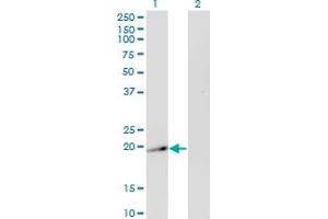 Western Blot analysis of TWIST2 expression in transfected 293T cell line by TWIST2 monoclonal antibody (M20A), clone 3B2. (TWIST2 anticorps  (AA 54-140))