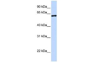 CSTF2 antibody used at 1 ug/ml to detect target protein.