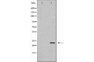 Western blot analysis of extracts of Mouse muscle, using CNTF antibody. (CNTF anticorps  (C-Term))