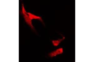 ABIN6278638 staining HuvEc by IF/ICC. (TAAR5 anticorps  (C-Term))