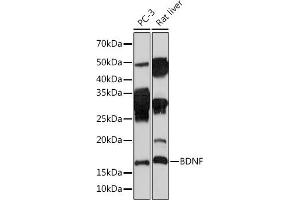 Western blot analysis of extracts of various cell lines, using BDNF Rabbit mAb (ABIN7265916) at 1:1000 dilution.