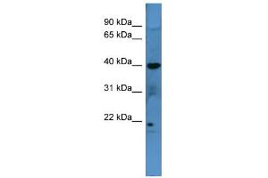 WB Suggested Anti-MRGPRX3 Antibody Titration: 0. (MRGPRX3 anticorps  (C-Term))