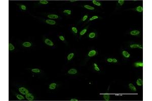 Immunofluorescence of monoclonal antibody to DLX1 on HeLa cell. (DLX1 anticorps  (AA 152-255))