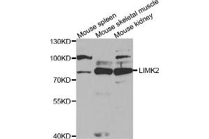Western Blotting (WB) image for anti-LIM Domain Kinase 2 (LIMK2) antibody (ABIN1876597) (LIMK2 anticorps)