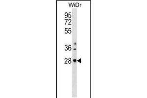 Western blot analysis in WiDr cell line lysates (35ug/lane). (THAP10 anticorps  (N-Term))
