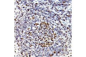 Immunohistochemistry of paraffin-embedded rat spleen using MCM2 Rabbit mAb (ABIN7268538) at dilution of 1:100 (40x lens).