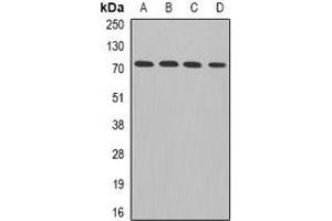 Western blot analysis of ADAM33 expression in Hela (A), MCF7 (B), mouse brain (C), rat heart (D) whole cell lysates. (ADAM33 anticorps)