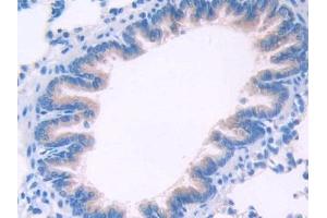Detection of KLb in Mouse Lung Tissue using Polyclonal Antibody to Klotho Beta (KLb)