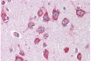 Anti-ACVR1 antibody IHC staining of human brain, cortex.