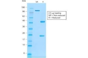 SDS-PAGE Analysis Purified CD20 Mouse Recombinant Monoclonal Antibody (rIGEL/773). (Recombinant CD20 anticorps)