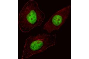 anti-Forkhead Box N3 (FOXN3) antibody