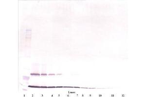 Image no. 3 for anti-Thymic Stromal Lymphopoietin (TSLP) antibody (ABIN465621) (Thymic Stromal Lymphopoietin anticorps)
