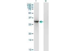 Western Blot analysis of BRMS1 expression in transfected 293T cell line by BRMS1 monoclonal antibody (M01), clone 2D4-2G11. (BRMS1 anticorps  (AA 1-246))
