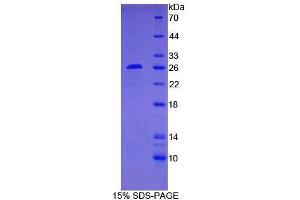 SDS-PAGE of Protein Standard from the Kit (Highly purified E. (Bcl-2 Kit ELISA)
