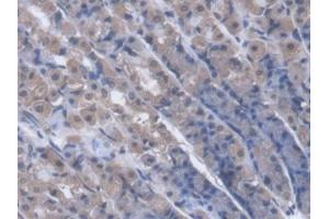 DAB staining on IHC-P; Samples: Rat Stomach Tissue (PNP anticorps  (AA 1-289))