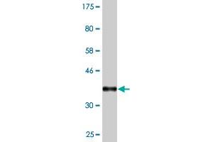 Western Blot detection against Immunogen (37. (ZBTB25 anticorps  (AA 331-435))