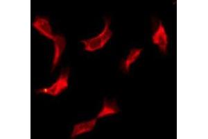 ABIN6276112 staining A549 by IF/ICC.