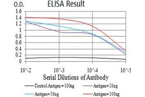 Black line: Control Antigen (100 ng), Purple line: Antigen(10 ng), Blue line: Antigen (50 ng), Red line: Antigen (100 ng), (Estrogen Receptor alpha anticorps  (pTyr537))