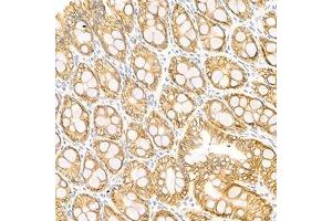 Immunohistochemistry analysis of paraffin-embedded rat colon using LI Cadherin (ABIN7074493) at dilution of 1: 1500