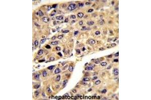 Immunohistochemistry (IHC) image for anti-Insulin-Like Growth Factor Binding Protein, Acid Labile Subunit (IGFALS) antibody (ABIN3003239)