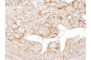 Immunohistochemistry (IHC) image for anti-Adducin 1 (Alpha) (ADD1) (AA 550-600) antibody (ABIN7453420) (alpha Adducin anticorps  (AA 550-600))