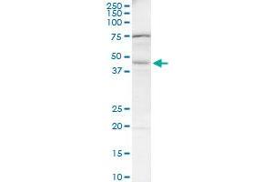 BAAT monoclonal antibody (M03), clone 1E4. (BAAT anticorps  (AA 258-355))