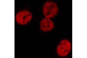 ABIN6267509 staining Hela by IF/ICC. (STAT1 anticorps  (pTyr701))